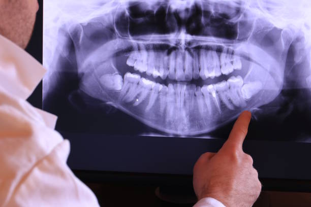 Best Emergency Root Canal Treatment in North Lewisburg, OH
