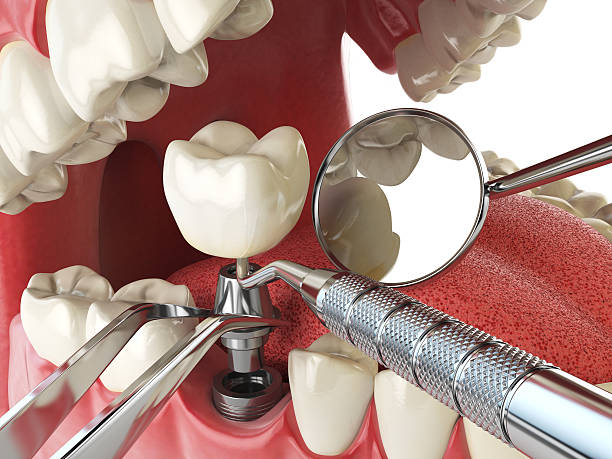 Best Emergency Orthodontic Repairs in North Lewisburg, OH